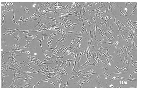 Osteoblastic cells growing in culture. Individual patient's cells have different morphology and growth rates.